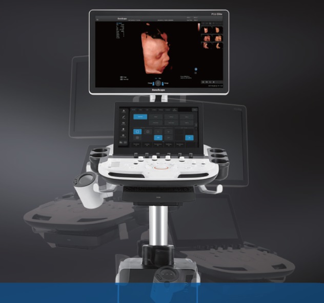 SONOSCAPE P11 ELİTE