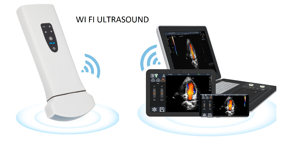 WI FI Ultrasonografi 