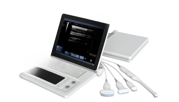 Ekonomik Siyah Beyaz (High End) PW Dopplerli - Ultrasonografi Cihazı