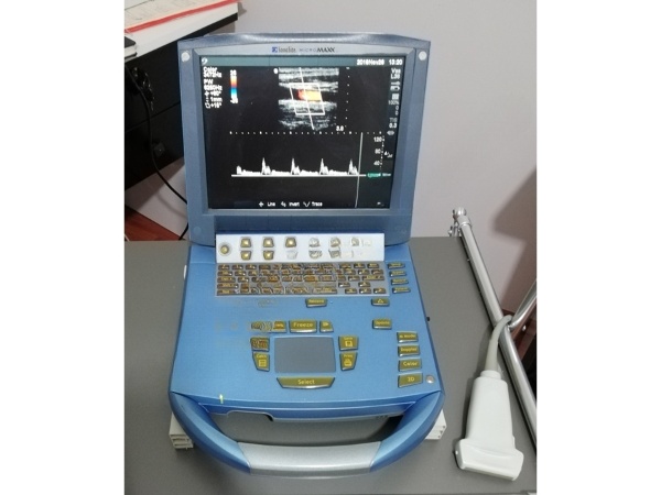 SONOSITE MICROMAXX