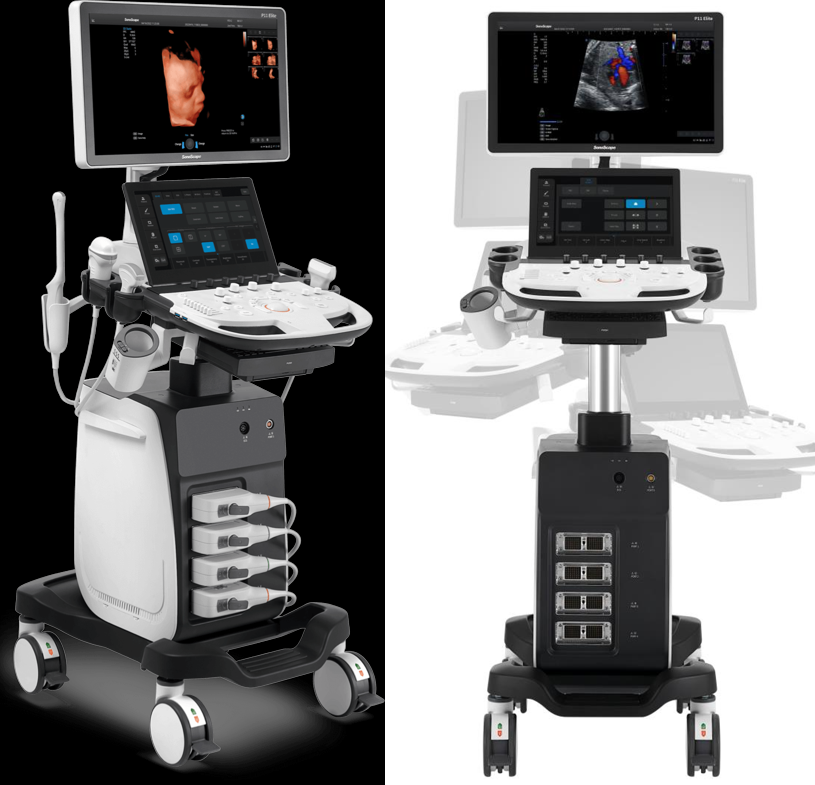 SONOSCAPE P11 ELİTE 4D RENKLİ DOPPLER USG