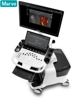 SONOSCAPE S80 ULTRASONOGRAFİ