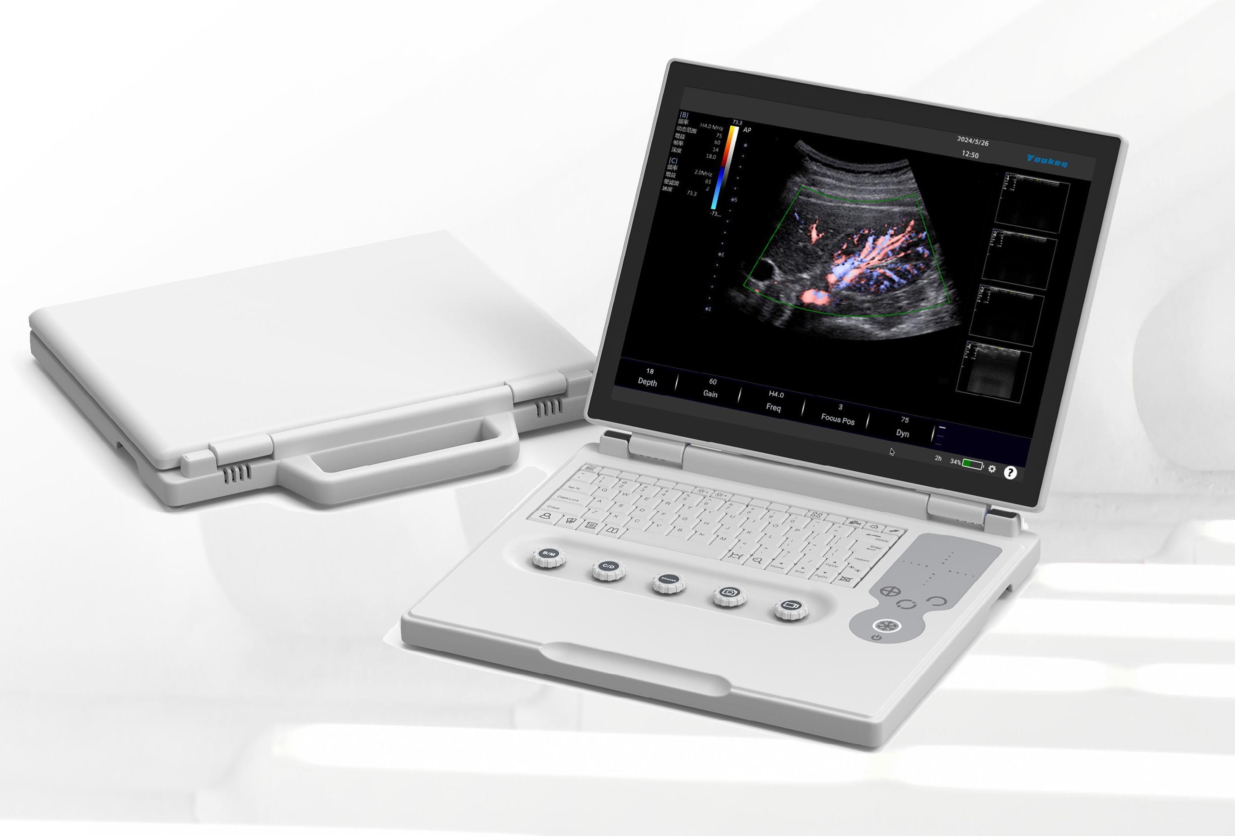 Ekonomik Renkli Dopplerli - Ultrasonografi Cihazı